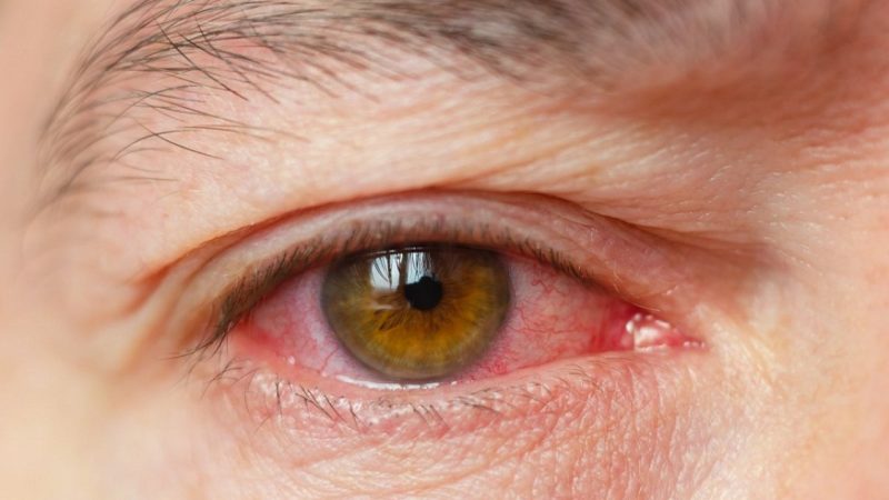 Things That Can Easily Cause Eye Strains, In You