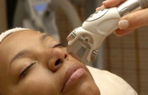 Melasma Treatment