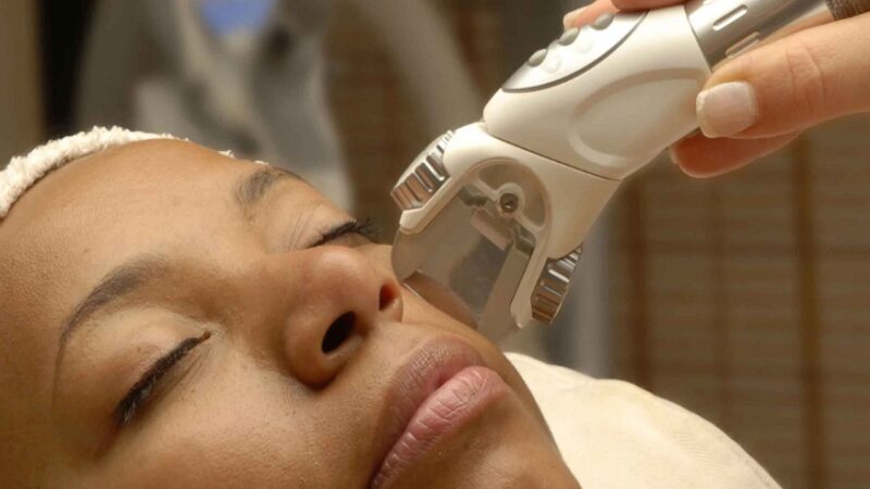 Melasma Treatment